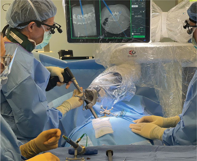 Intra-operative Placement